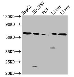 UGT1A1 Antibody