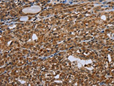 UHRF2 Antibody