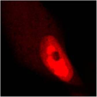 Anti-UL89 (HCMV) antibody