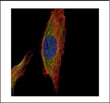 UNC13B Rabbit Polyclonal Antibody