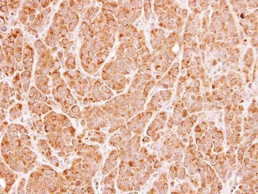 UNC13B Rabbit Polyclonal Antibody