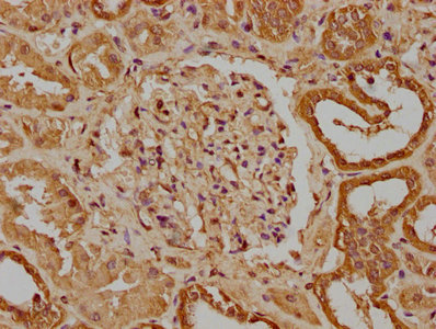 UNC13B Antibody