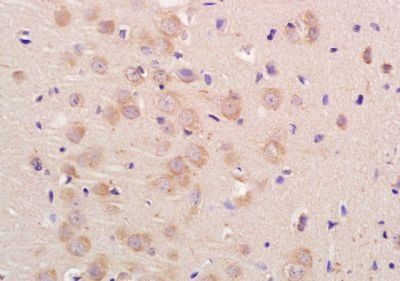 UNC80 Rabbit Polyclonal Antibody