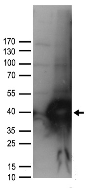 UNG Antibody