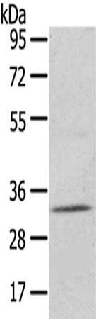 UPP2 Antibody
