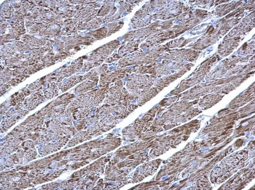 ubiquinol-cytochrome c reductase core protein 1 Antibody