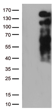 UQCRFS1 Antibody