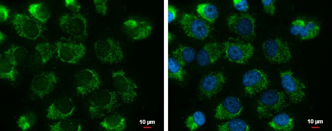 UQCRFS1 Rabbit Polyclonal Antibody