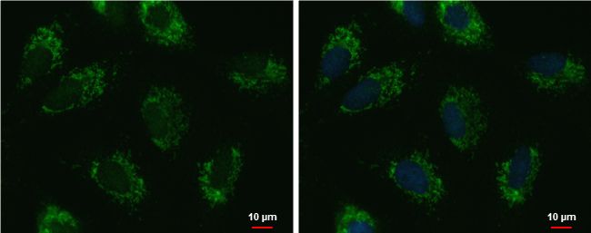 UQCRFS1 Rabbit Polyclonal Antibody