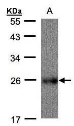 UQCRFS1 Rabbit Polyclonal Antibody