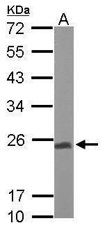 UQCRFS1 Rabbit Polyclonal Antibody