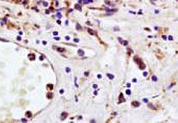 Uroplakin Ia Rabbit Polyclonal Antibody