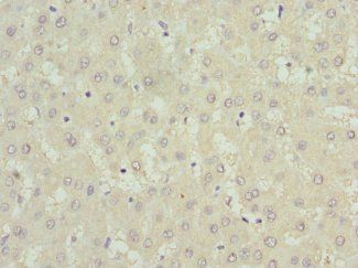 USP15 Antibody