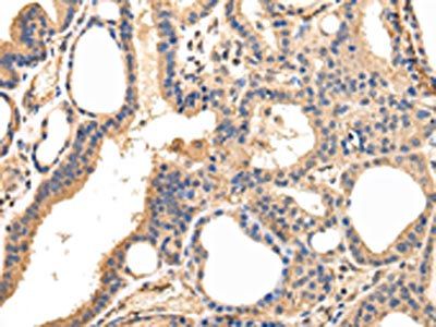 USP15 Antibody