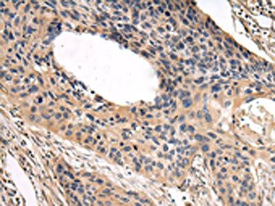 USP15 Antibody