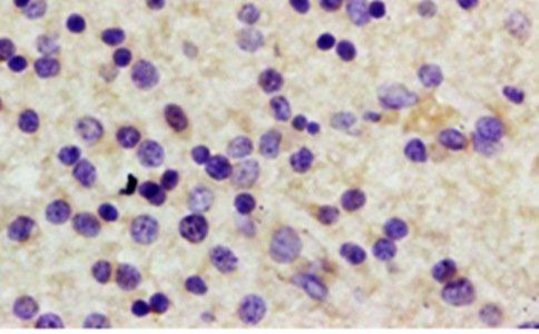 USP1 Rabbit Polyclonal Antibody