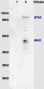 USP1 Rabbit Polyclonal Antibody