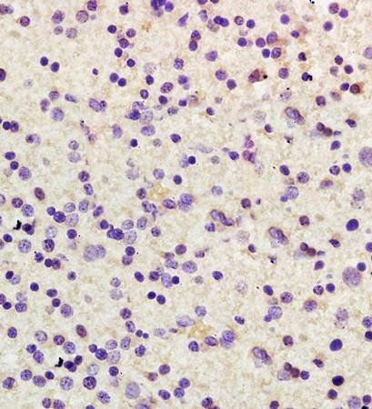 USP1 Rabbit Polyclonal Antibody