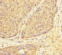 USP28 Antibody