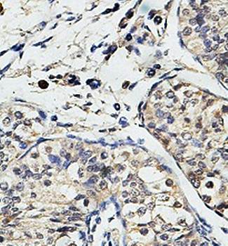 USP29 Rabbit Polyclonal Antibody