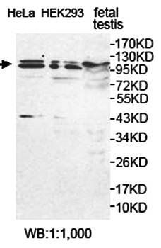USP29 Rabbit Polyclonal Antibody