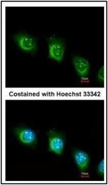 USP47 Rabbit Polyclonal Antibody