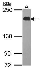 USP47 Rabbit Polyclonal Antibody