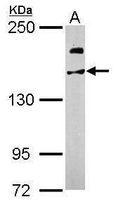USP47 Rabbit Polyclonal Antibody
