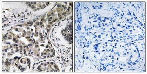 USP6NL Antibody