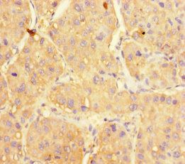 UGP2 Antibody