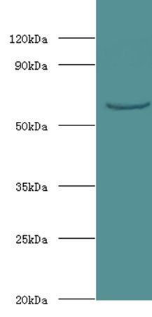 UGP2 Antibody