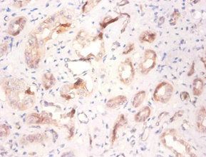 ATP6V1F Antibody