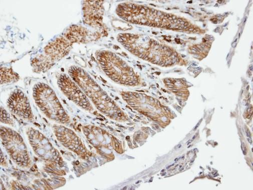 VAM1 Rabbit Polyclonal Antibody