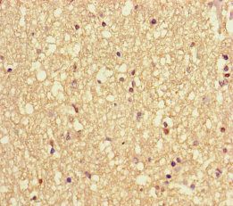VAMP1 Antibody