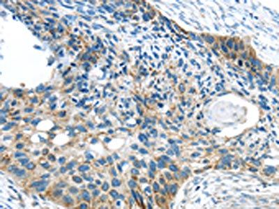 VAMP1 Antibody