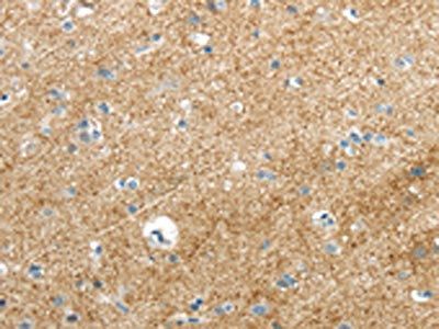 VAMP1 Antibody