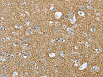 VAMP2 Antibody