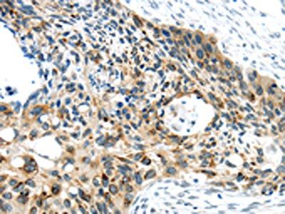 VAMP2 Antibody