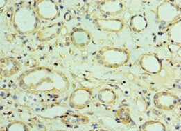 VAMP3 Antibody
