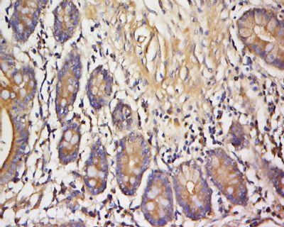 Cellubrevin Rabbit Polyclonal Antibody