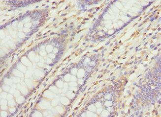 VANGL1 Antibody