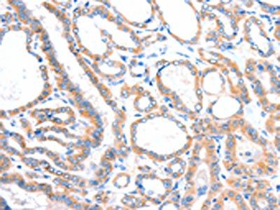 VANGL1 Antibody