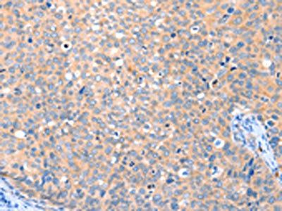VANGL1 Antibody