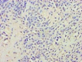 AVP Antibody