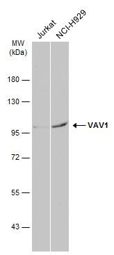 VAV1 Rabbit Polyclonal Antibody