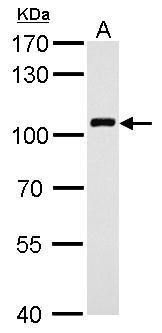 VAV1 Rabbit Polyclonal Antibody