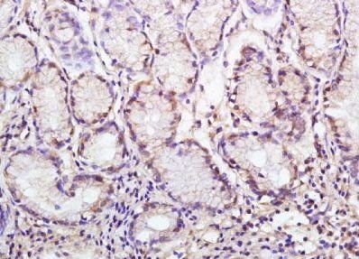 VAV1 Rabbit Polyclonal Antibody