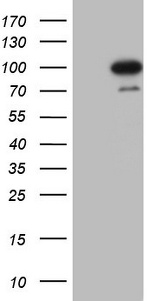 VEGF Receptor 2 Antibody