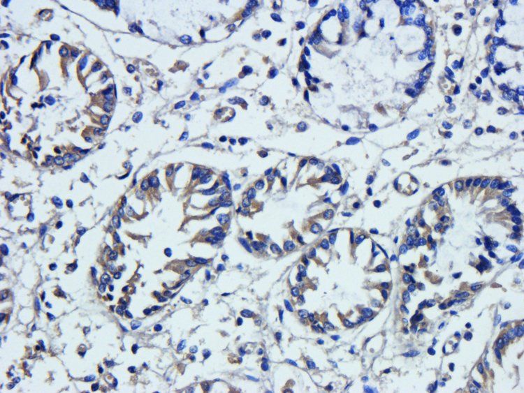 VEGF165 antibody
