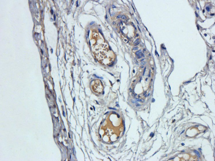 VEGF165 antibody